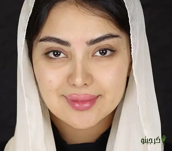 سالن زیبایی بهاره کلهر قبل
