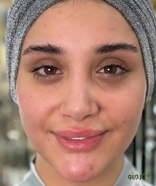 مدل قصر عروس قبل